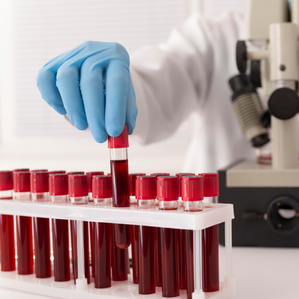 Hemodialysis